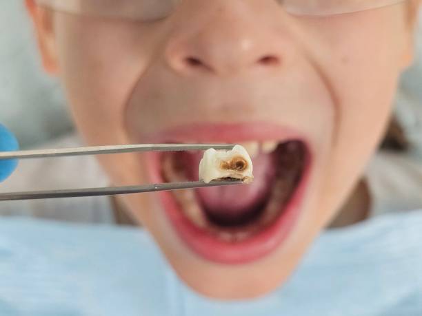 Best Cosmetic Emergency Dentistry in Pea Ridge, WV
